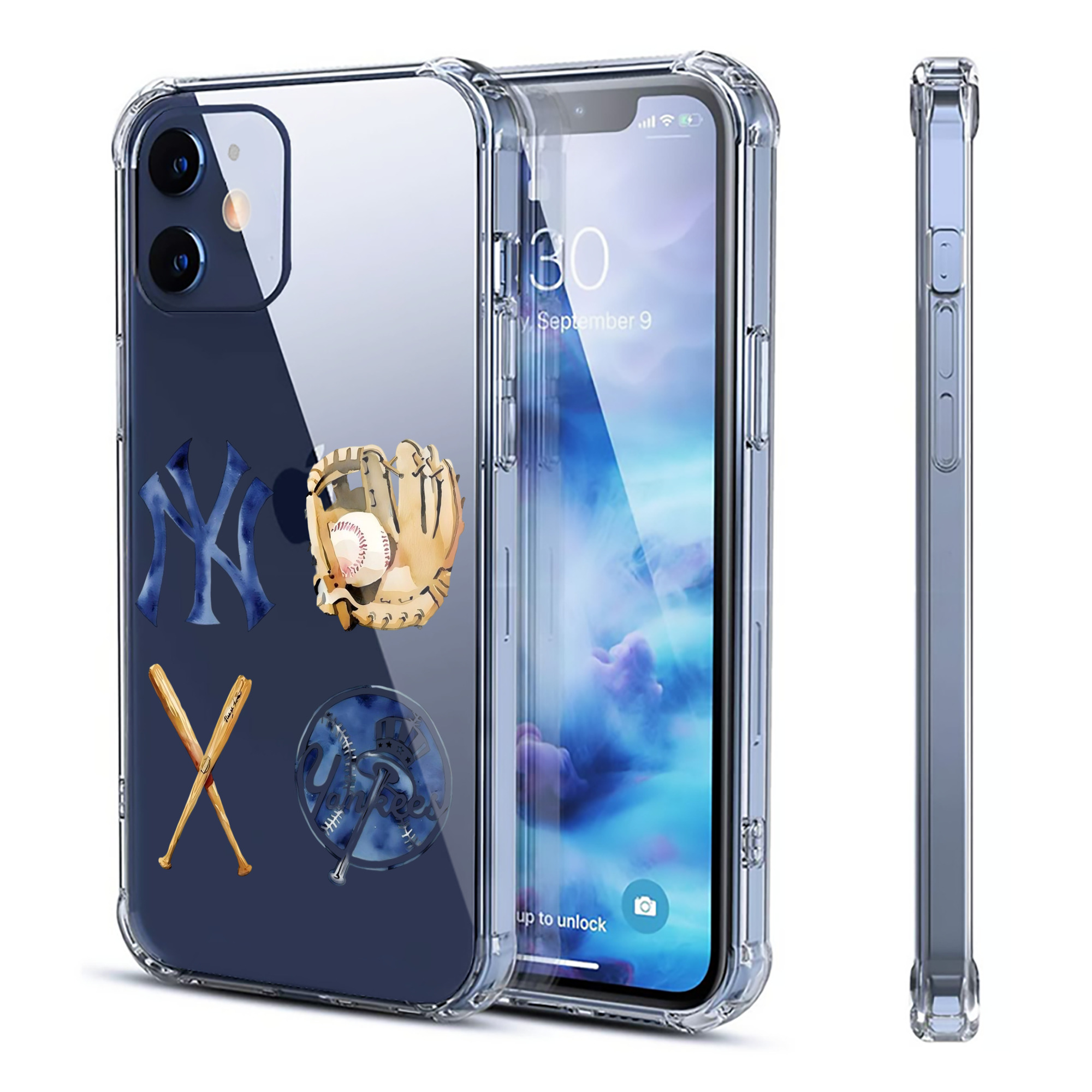 New York Yankees Baseball Clear IPhone 12 Case – Soft TPU With UV Print – Enhanced Drop Protection, Precise Fit, Anti-Fingerprint, Customizable Design, Scratch-Resistant, Yellow-Resistant